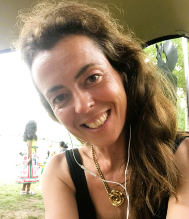 Anke Edema